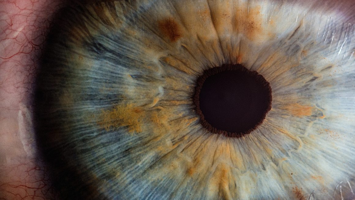 Close up image of eye, including pupil and blue, brown and orange iris.